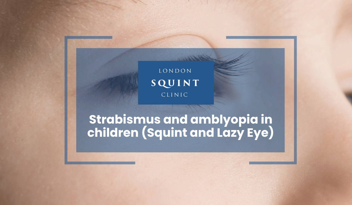 Strabismus and amblyopia in children