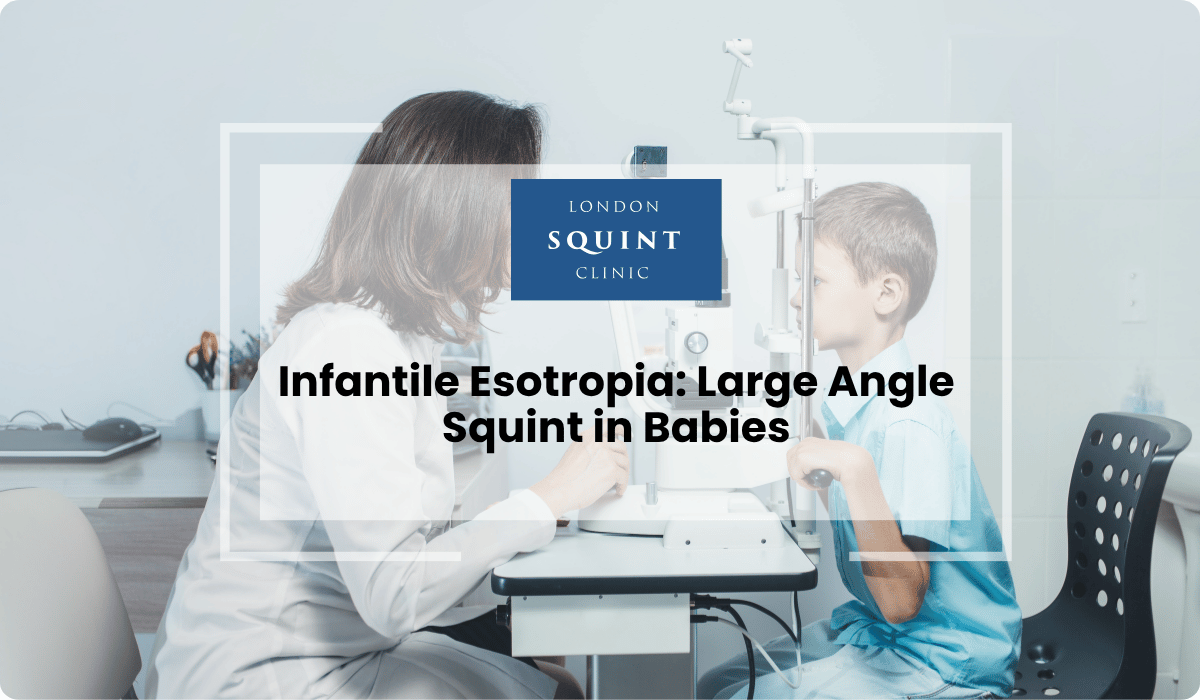 infantile esotropia large angle squint babies