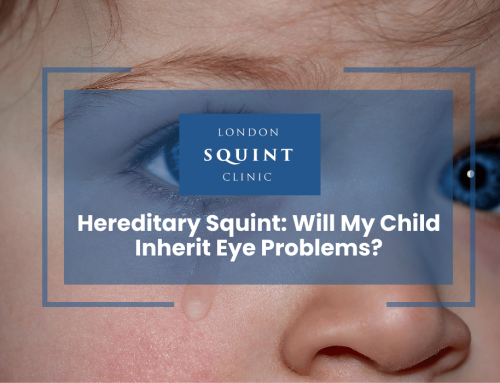 Hereditary Squint: Will My Child Inherit Eye Problems?