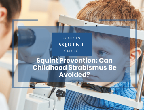 Squint Prevention: Can Childhood Strabismus Be Avoided?