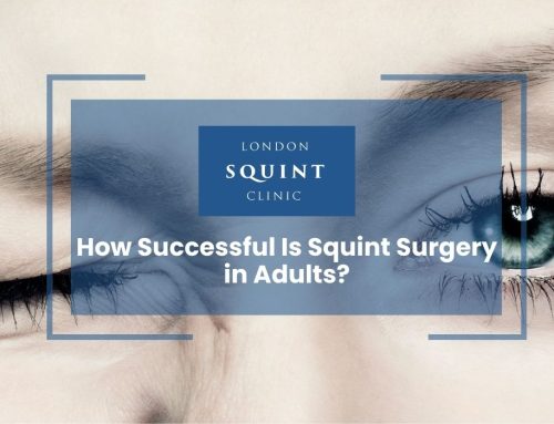 How Successful Is Squint Surgery in Adults?