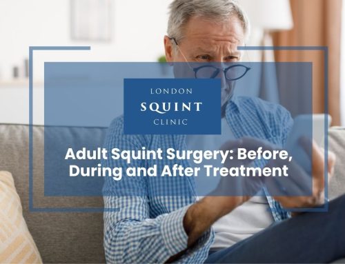 Adult Squint Surgery: Before, During and After Treatment