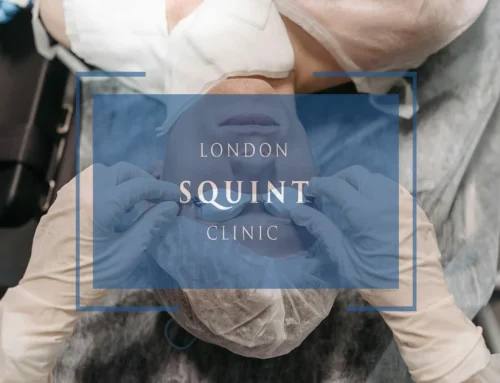 The Complete Guide to Private Squint Surgery Costs in the UK