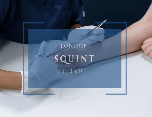 Surgical Techniques for Diplopia: How Adjustable Sutures Improve Precision