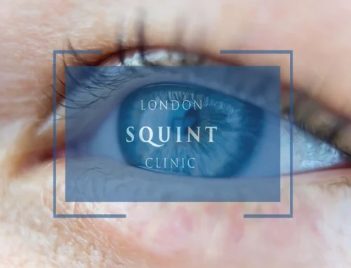How Thyroid Eye Disease Leads to Double Vision and Surgical Solutions