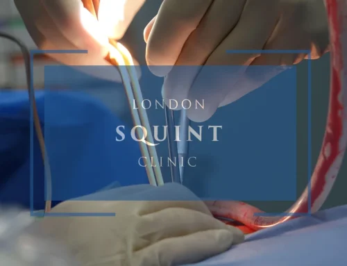 Is Adjustable Suture Surgery Suitable for All Types of Squint?
