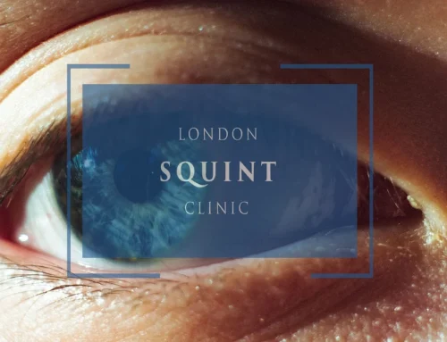 When Can You Return to Driving, Work, and Exercise After Double Vision Surgery?
